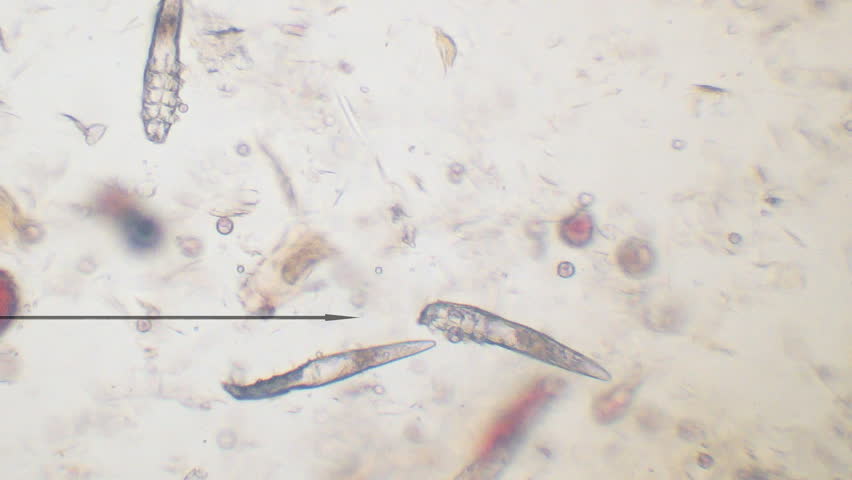 scabies control and treatments for office building and home