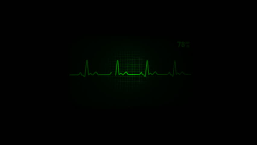 Animated Lifeline Stock Footage Video 3783236 - Shutterstock