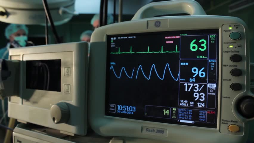 machine used to monitor heartbeat