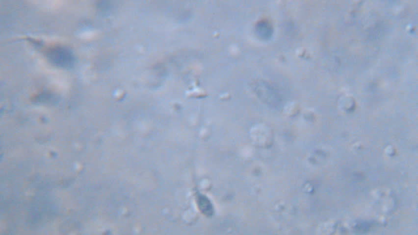 Sperm Motion Of Health Man Under Microscope, Magnification 1000x Stock 