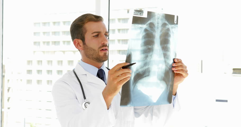 Female Doctor Looking At Xray Photo, Isolated On White Stock Footage ...